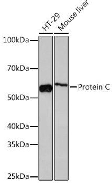 Anti-Protein C Antibody (CAB4532)