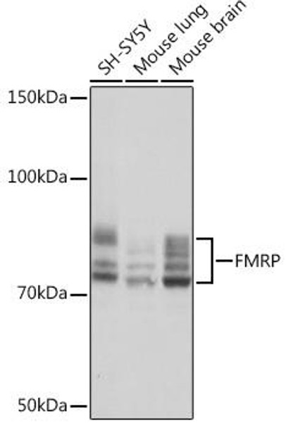 Anti-FMRP Antibody (CAB4539)
