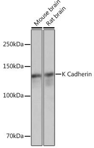 Anti-K Cadherin Antibody (CAB4689)