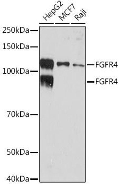 Anti-FGFR4 Antibody (CAB9197)