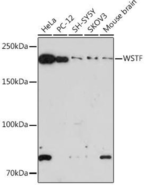 Anti-WSTF Antibody (CAB9519)