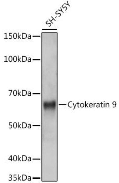 Anti-Cytokeratin 9 Antibody (CAB9621)