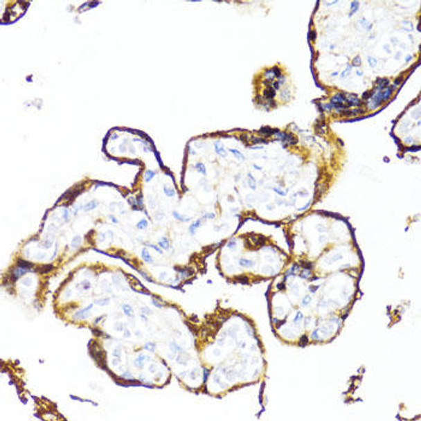 Anti-HSD17B1 Antibody (CAB10839)