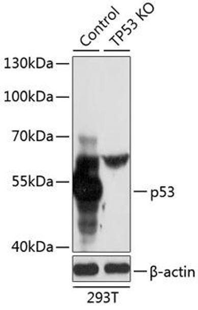 Anti-p53 Antibody (CAB11232)[KO Validated]