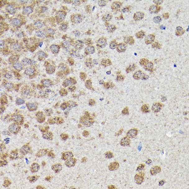 Anti-GSK3Beta Antibody (CAB11360)