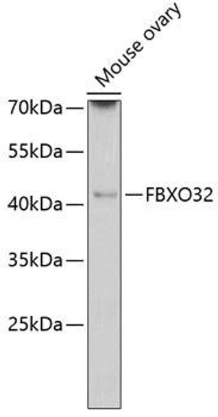 Anti-FBXO32 Antibody (CAB11439)