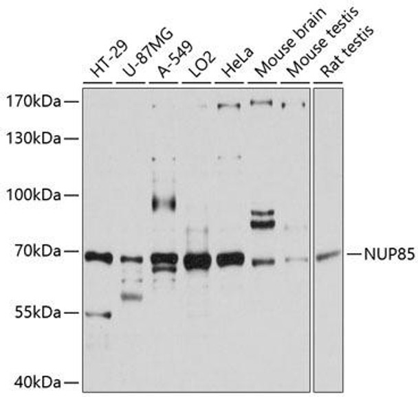 Anti-NUP85 Antibody (CAB11629)