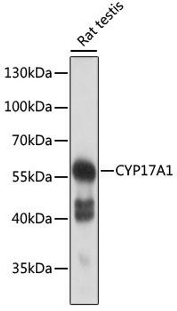Anti-CYP17A1 Antibody (CAB13968)