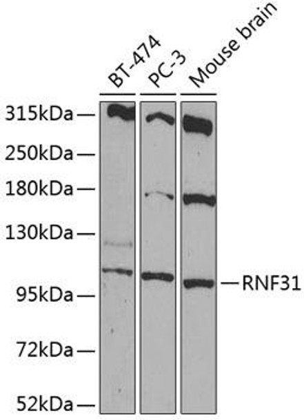 Anti-RNF31 Antibody (CAB14139)