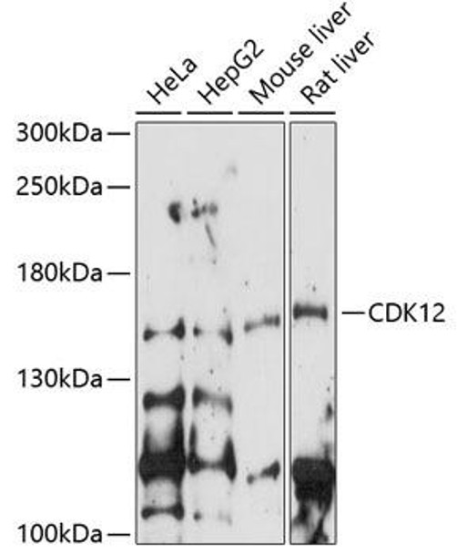 Anti-CDK12 Antibody (CAB14894)