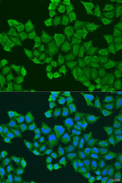 Anti-ULBP2 Antibody (CAB15194)