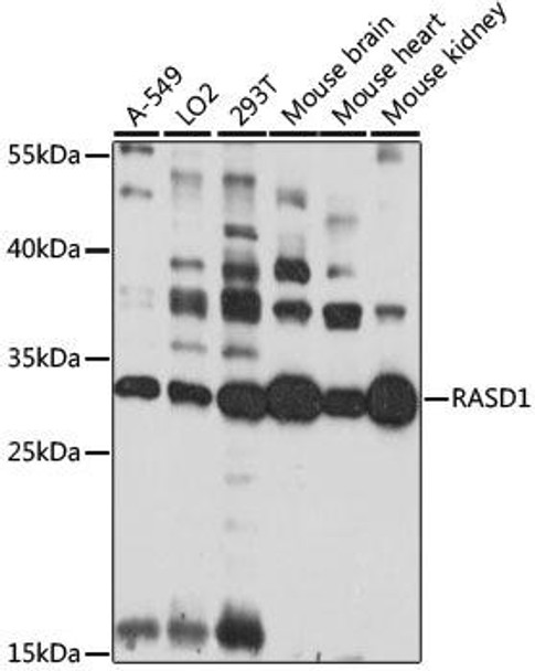 Anti-RASD1 Antibody (CAB15451)