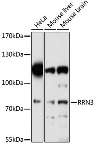 Anti-RRN3 Antibody (CAB16705)