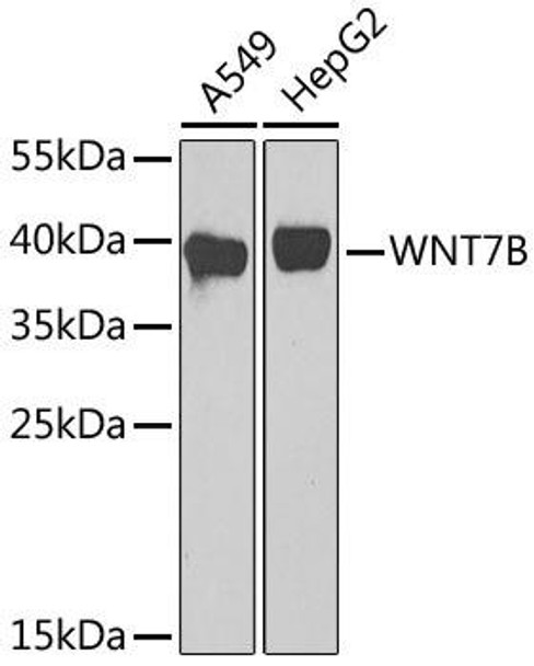 Anti-WNT7B Antibody (CAB17004)