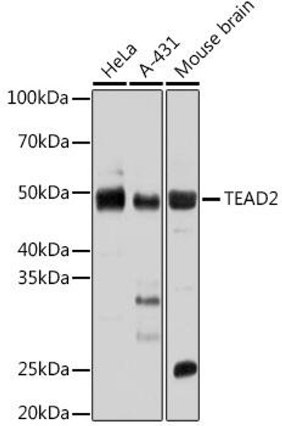 Anti-TEAD2 Antibody (CAB17407)