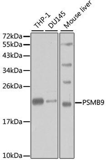 Anti-PSMB9 Antibody (CAB1771)