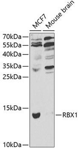 Anti-RBX1 Antibody (CAB1832)