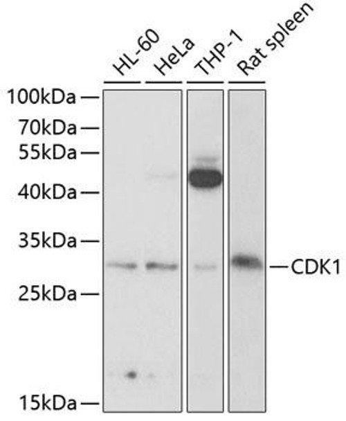 Anti-CDK1 Antibody (CAB2438)