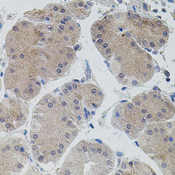 Anti-ASK1 Antibody (CAB3271)