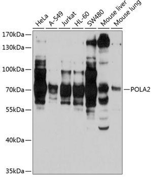 Anti-POLA2 Antibody (CAB3400)