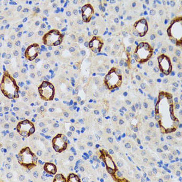 Anti-GABARAP Antibody (CAB5616)