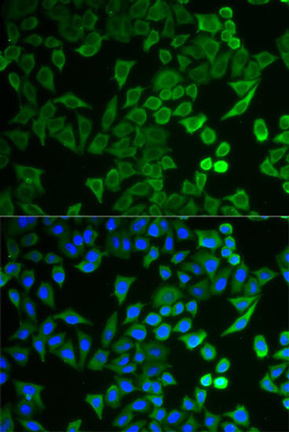 Anti-NPRL2 Antibody (CAB5859)