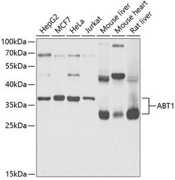 Anti-ABT1 Antibody (CAB5898)