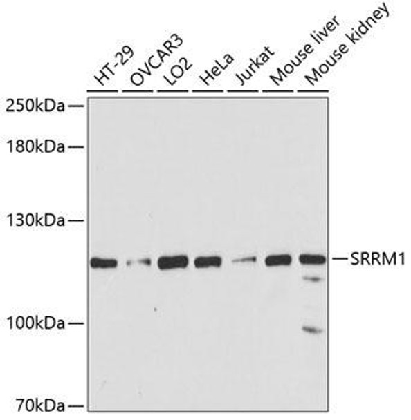 Anti-SRRM1 Antibody (CAB6066)