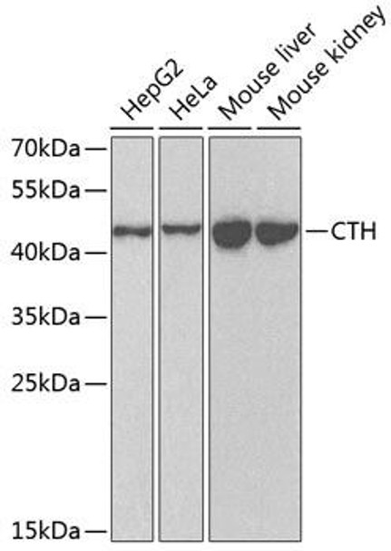 Anti-CTH Antibody (CAB6121)