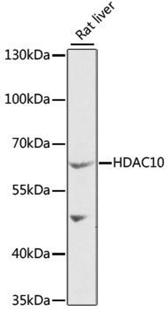 Anti-HDAC10 Antibody (CAB6184)