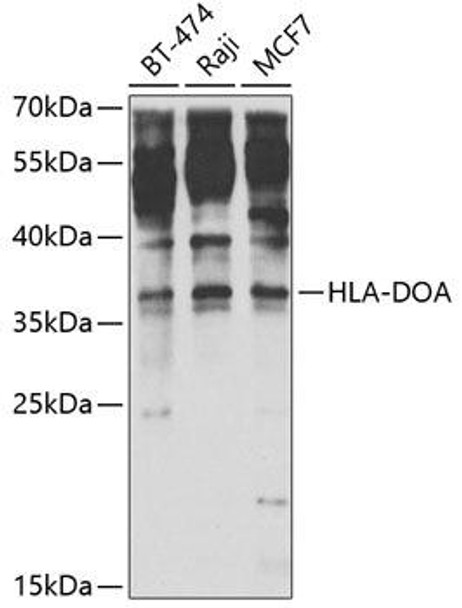 Anti-HLA-DOA Antibody (CAB6923)