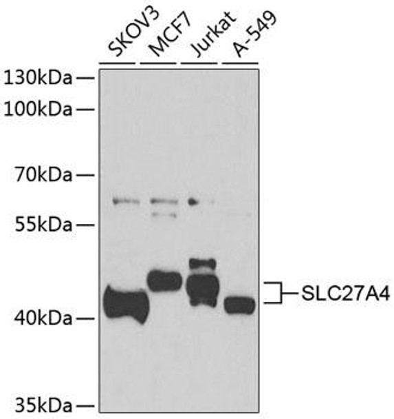 Anti-SLC27A4 Antibody (CAB7579)