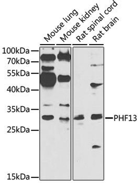 Anti-PHF13 Antibody (CAB7854)