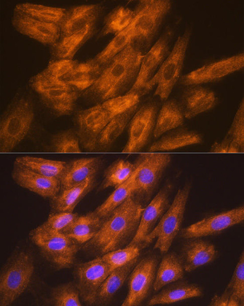 Anti-DSPP Antibody (CAB8413)