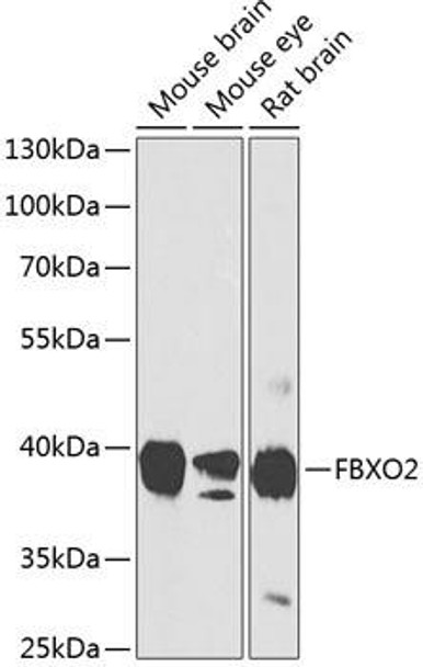 Anti-FBXO2 Antibody (CAB8579)