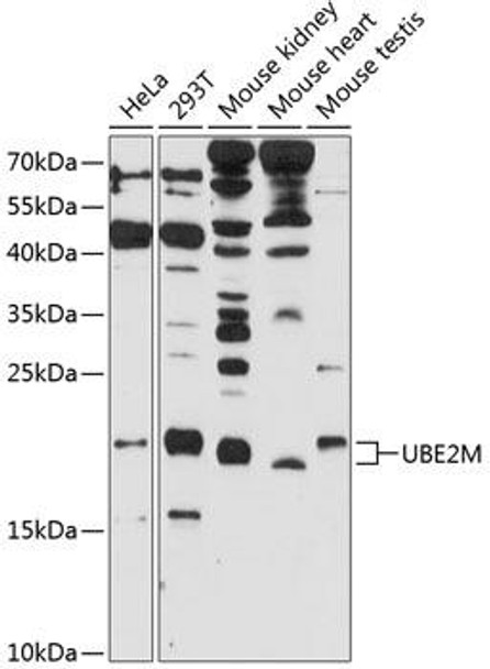 Anti-UBE2M Antibody (CAB9007)