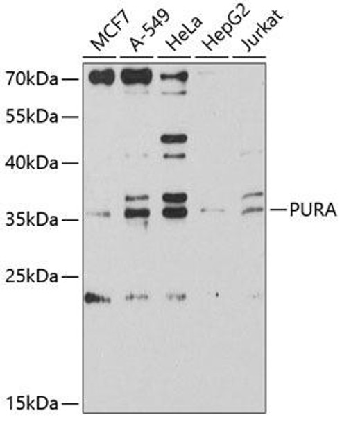 Anti-PURA Antibody (CAB9296)