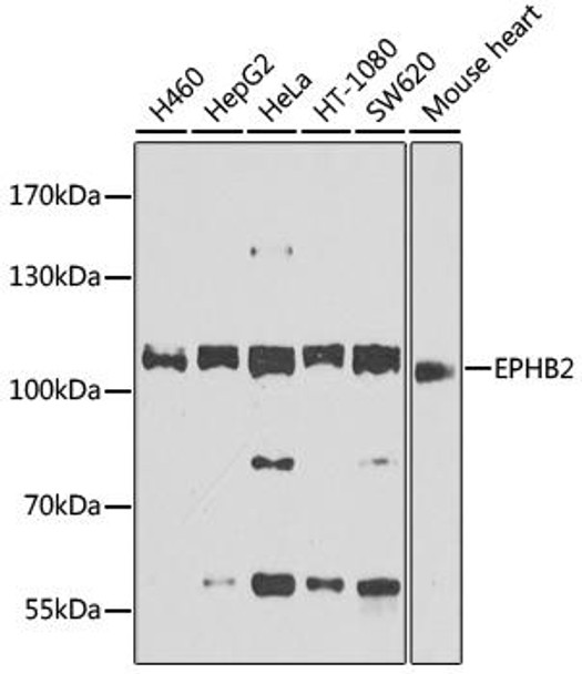 Anti-EPHB2 Antibody (CAB9813)
