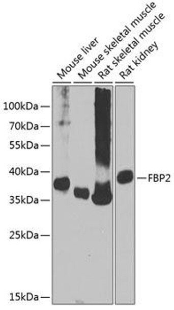 Anti-FBP2 Antibody (CAB9850)