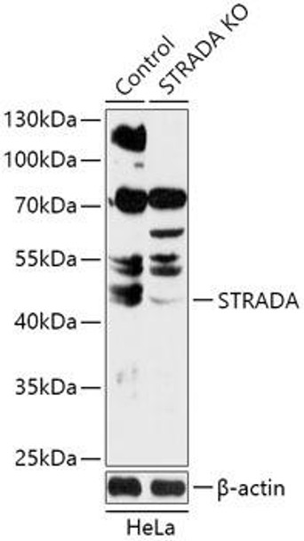 Anti-STRADA Antibody (CAB18012)[KO Validated]