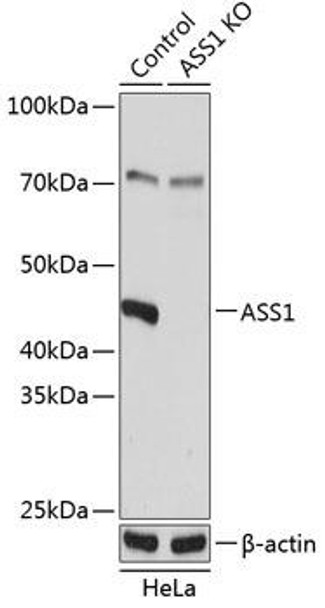Anti-ASS1 Antibody (CAB19878)[KO Validated]