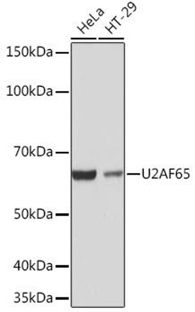 Anti-U2AF65 Antibody (CAB4552)