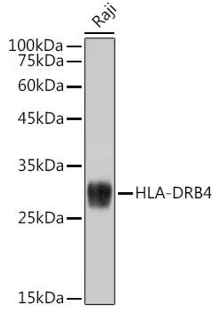 Anti-HLA-DRB4 Antibody (CAB0439)