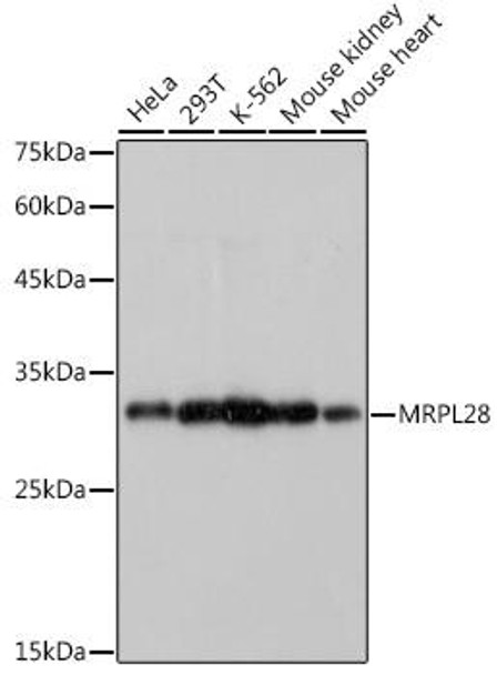 Anti-MRPL28 Antibody (CAB0452)