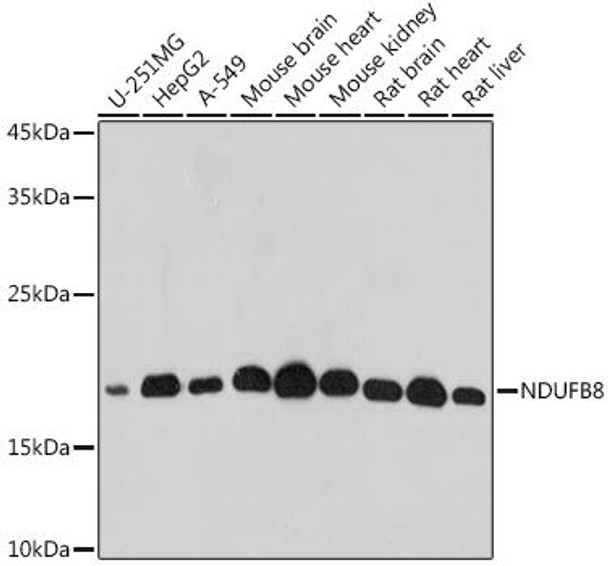 Anti-NDUFB8 Antibody (CAB20457)