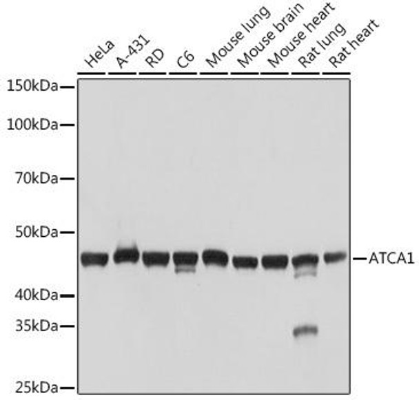 Anti-alpha-Actin-1 (ACTA1) Antibody (CAB2319)