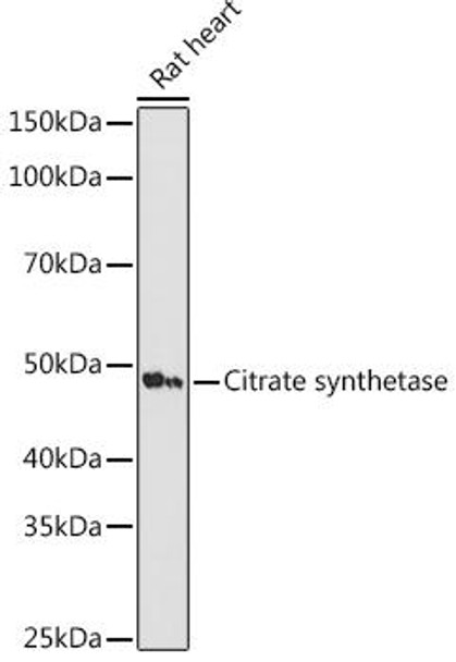 Anti-Citrate synthetase Antibody (CAB4569)