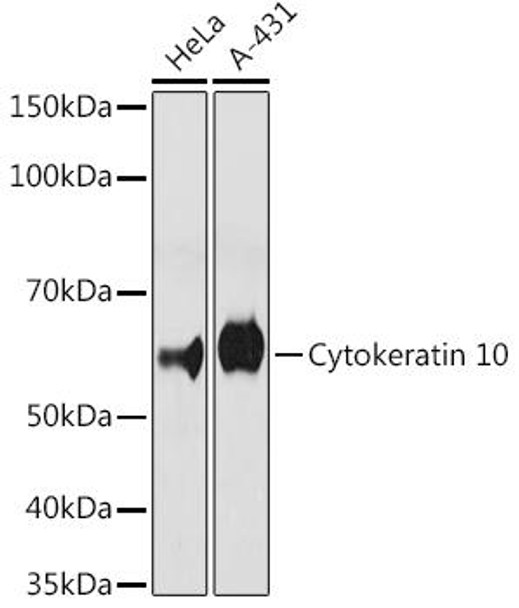 Anti-Cytokeratin 10 Antibody (CAB4669)