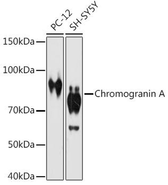Anti-Chromogranin A Antibody (CAB9576)