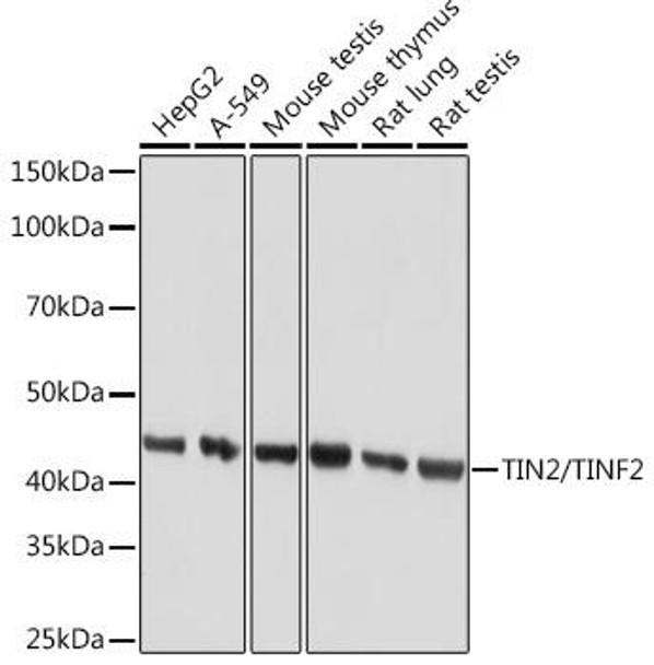 Anti-TIN2/TINF2 Antibody (CAB9750)